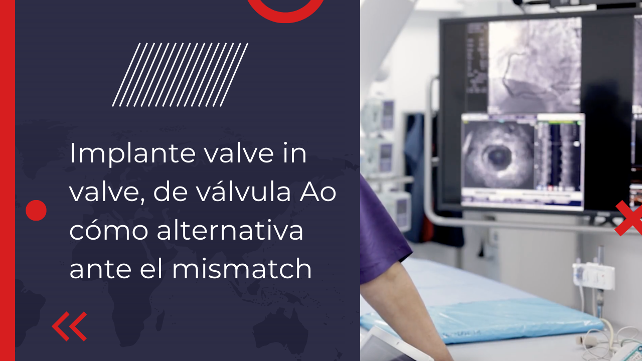 Implante Valve in Valve